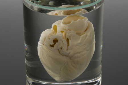 A genetically engineered pig heart in a glass jar